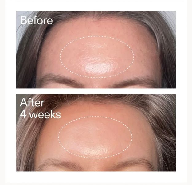 Сироватка з ретиноїдами для вишукання The INKEY List Advanced Retinal Serum 15 ml 111 фото