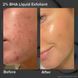 Ексфоліант для обличчя Paula's Choice Skin Perfecting 6% Mandelic Acid and 2% Lactic Acid Liquid Exfoliant 88 мл 2255998658 фото 6