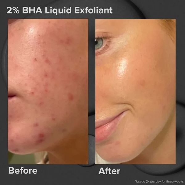 Ексфоліант для обличчя з AHA Paula's Choice Skin Perfecting 6% Mandelic Acid and 2% Lactic Acid Liquid Exfoliant 2256080100 фото