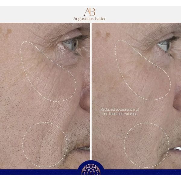 Сироватка для блиску Augustinus Bader The Serum with TFC8 7ml 2491401643 фото