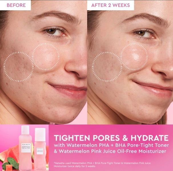 Увлажняющий крем без масла для лица Glow Recipe Mini Watermelon Pink Juice Oil-Free Moisturizer 25 мл 25 фото